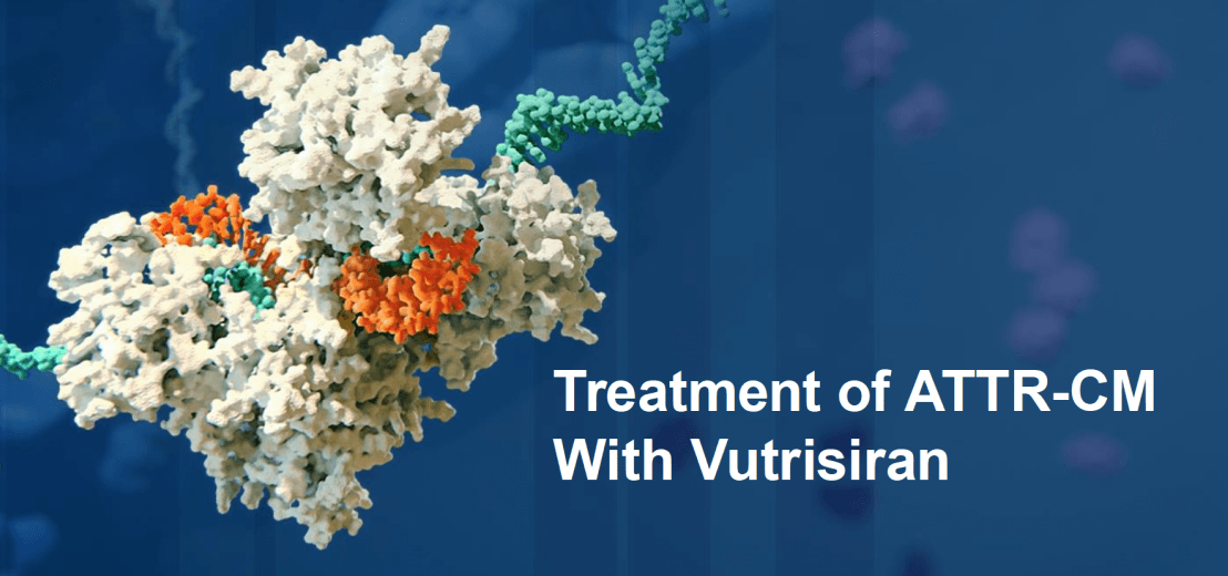 Treatment of ATTR‑CM with Vutrisiran